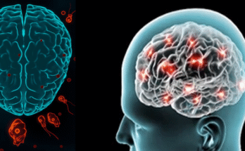 Deadly ‘Brain-Eating Amoeba’ Sparks Health Scare in Kerala, 19 Dead