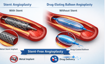 Stent-Free (स्टेंट-फ्री) Heart ट्रीटमेंट: क्या है ड्रग-एल्यूटिंग बैलून (Drug-Eluting Balloon) एंजियोप्लास्टी?