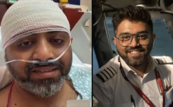 Flydubai Pilot Smit Machchhar’s Skull Fracture, Vision Injury Revealed